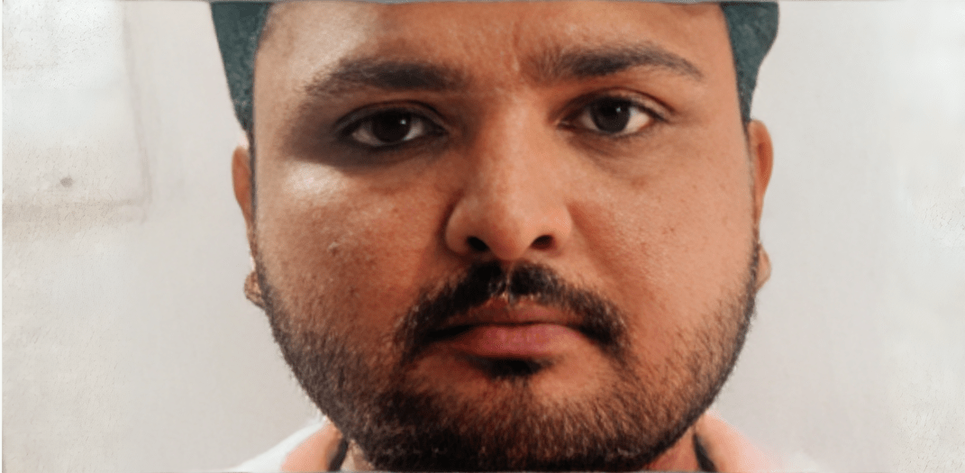 बदायूं जिले में बुखार का कहर, एक और युवक की मौत